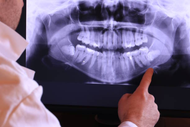 Best Pediatric Emergency Dentist in South Hooksett, NH